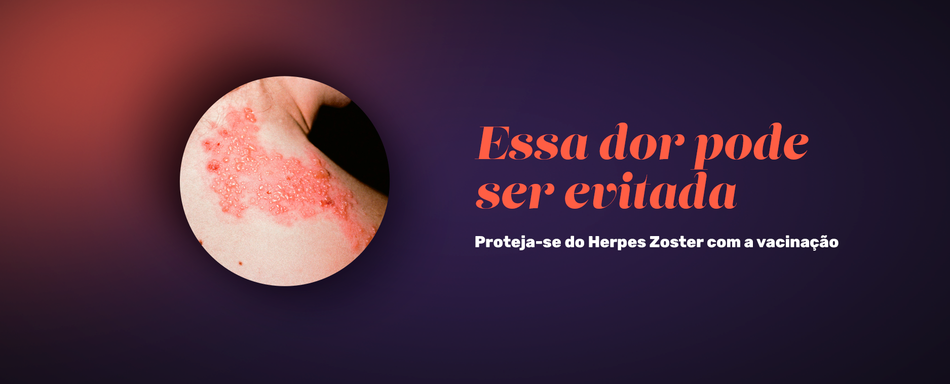 Essa dor pode ser evitada: proteja-se do Herpes Zoster com a vacinação